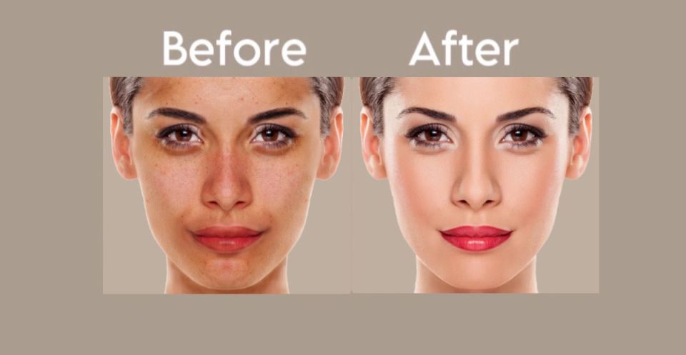 Unlock Radiance: Embrace Vibrant Skin and no more DULL 0R DRY SKIN