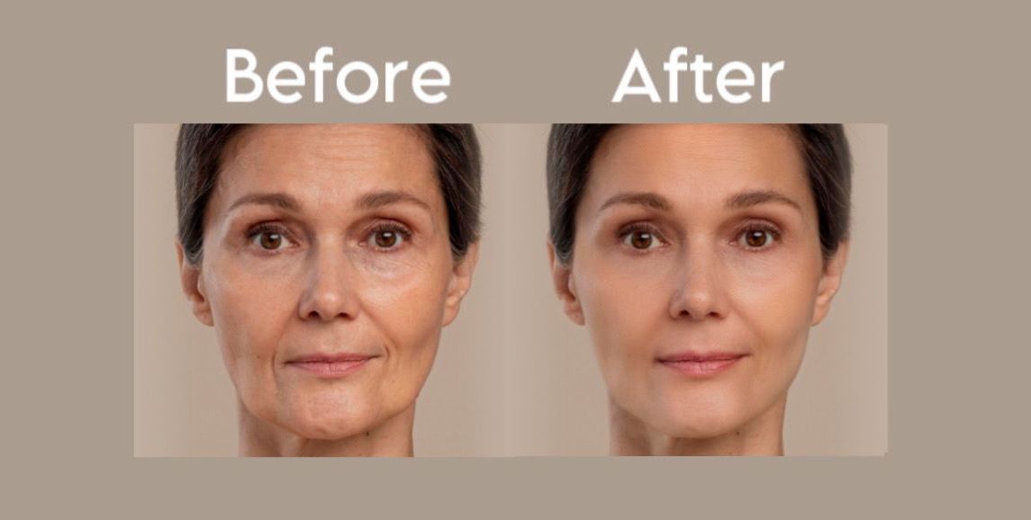Age like a Boss: Navigating the FINE LINES AND WRINKLES Journey