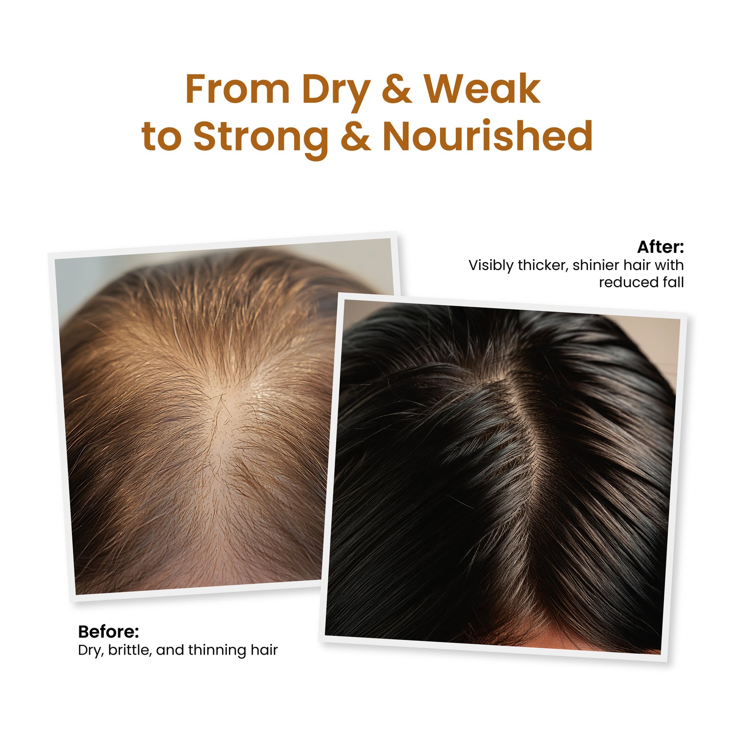Trycone Rosemary Hair Oil – Enriched with Real Herbs &amp; Vitamin E - 200 ml