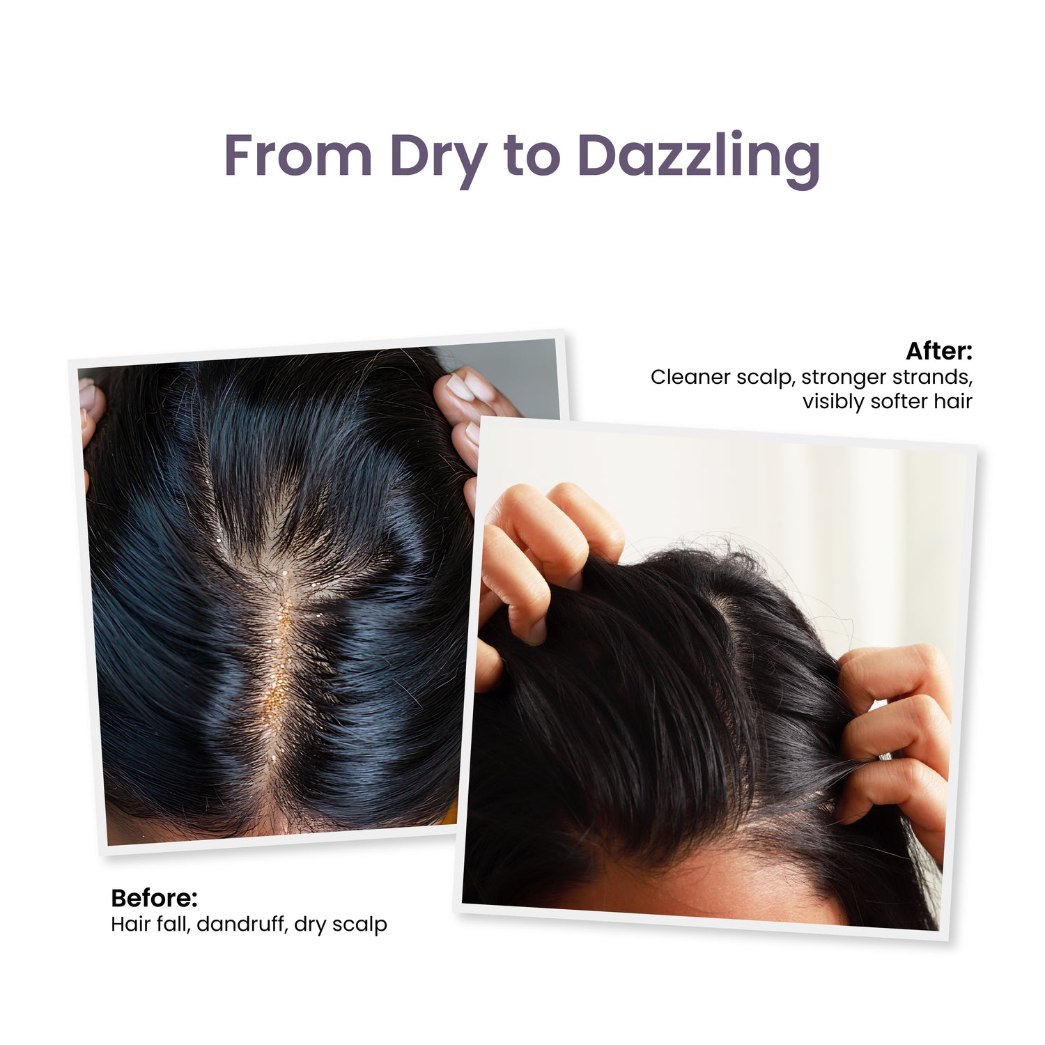 Trycone Rosemary Hair Shampoo Enriched with Hydrolyzed Wheat Protein &amp; Natural Actives – 200 Ml